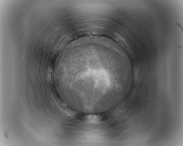 X0000099540169200806131157