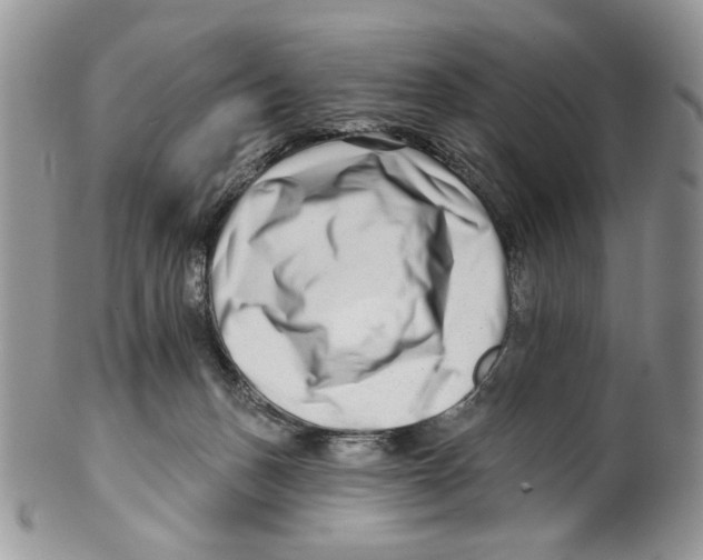 X0000099540175200806131157