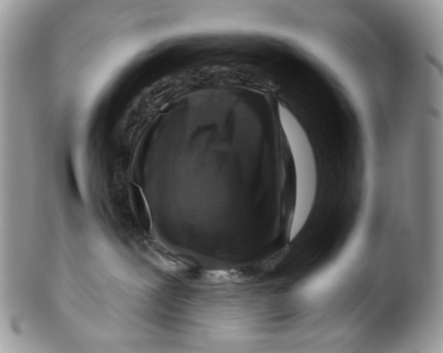 X0000099540239200806131156