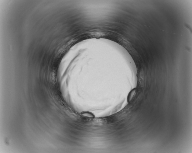 X0000099540330200806131155