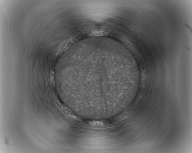 X0000099540361200806131155