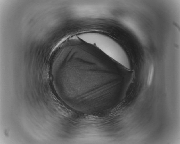 X0000099540387200806131154