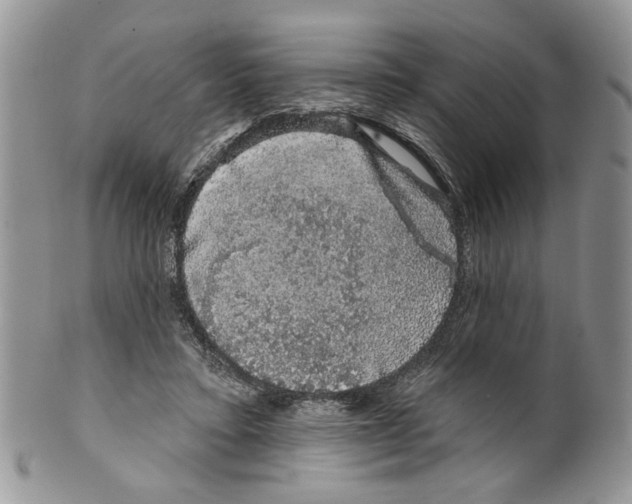 X0000099540403200806131154