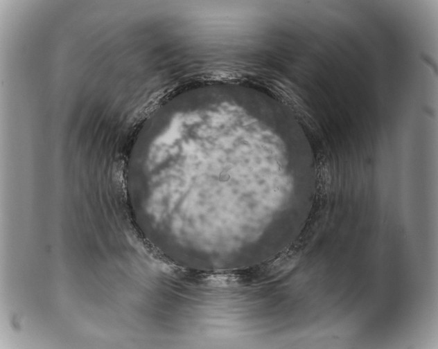 X0000099540415200806131154