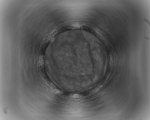 X0000099540467200806131153