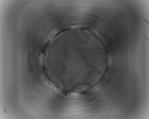 X0000099540475200806131153