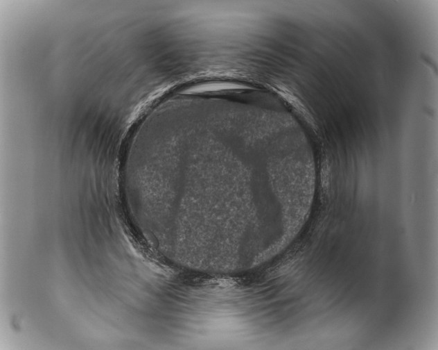 X0000099540492200806131152