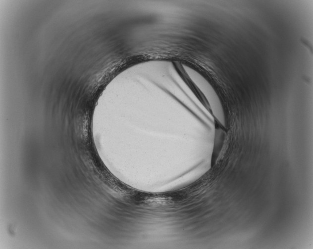 X0000099540499200806131152