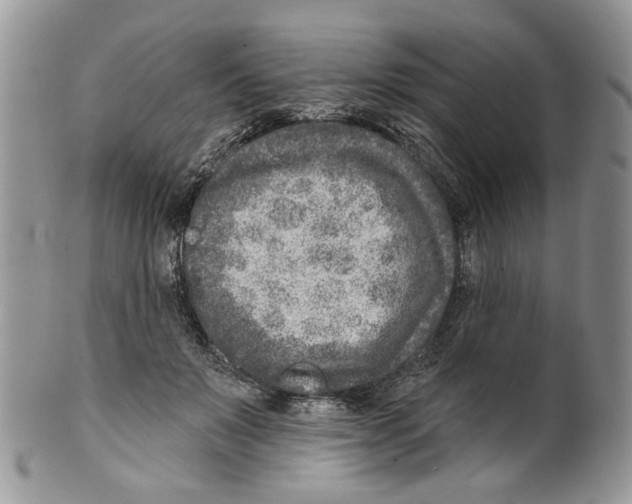 X0000099540503200806131152