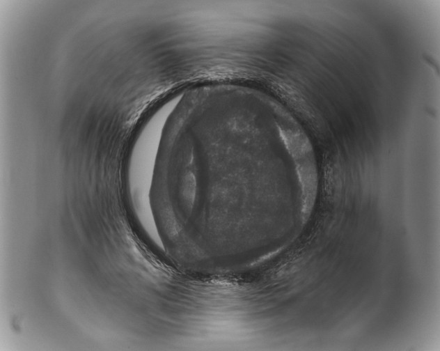 X0000099540592200806131151