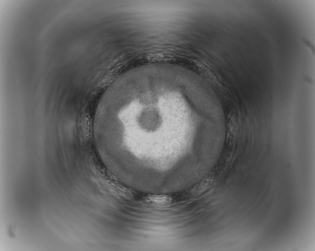 X0000099540659200806131150