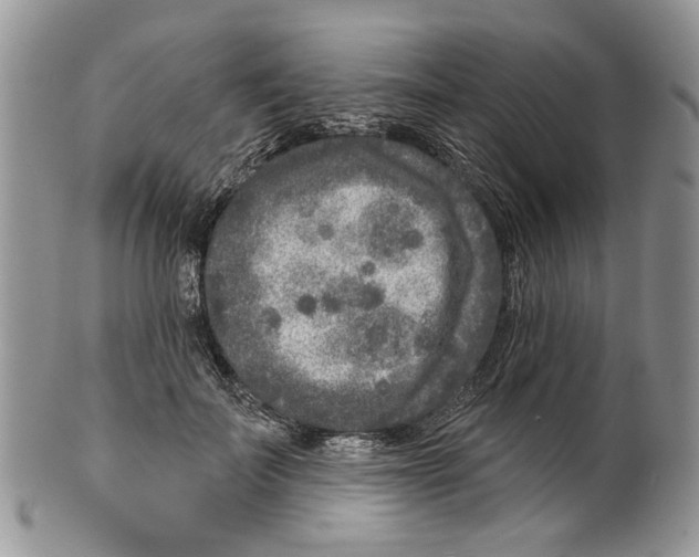 X0000099540699200806131149