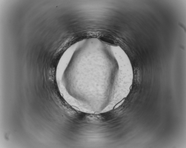 X0000099540712200806131149