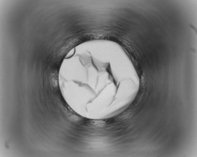 X0000099540719200806131149