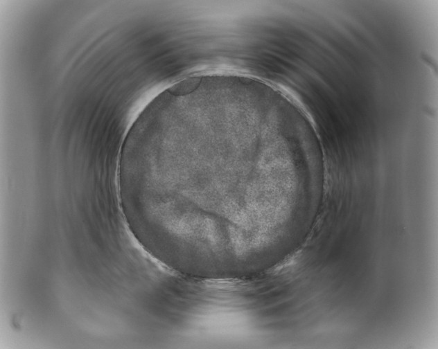 X0000099540863200806131147