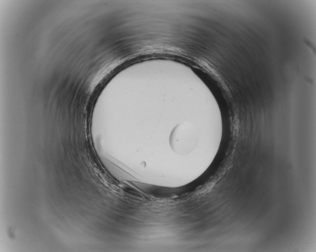 X0000099540877200806131147