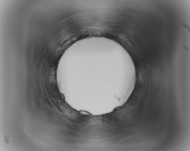 X0000099540964200806131145