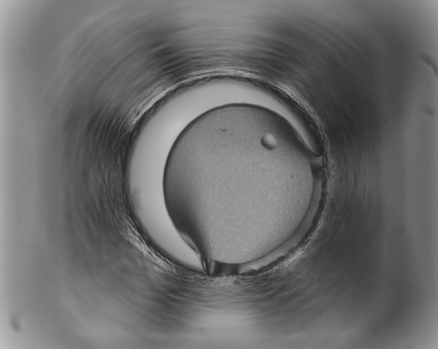 X0000099540969200806131145