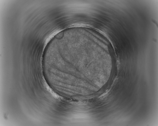 X0000099540995200806131145