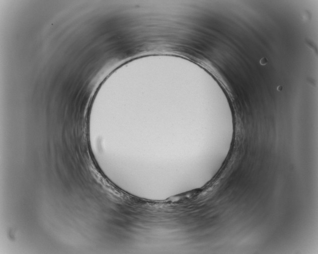 X0000099541004200806131145