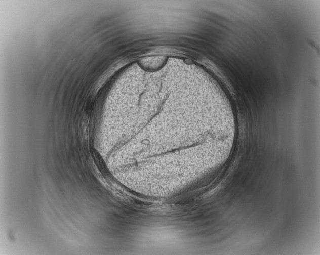 X0000099541049200806131145