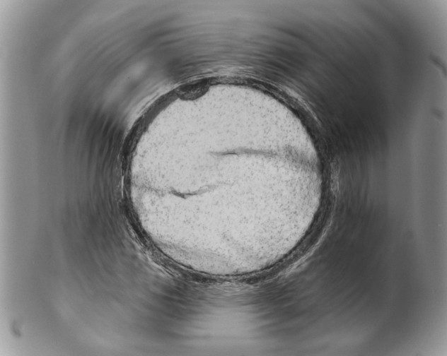 X0000099541117200806131143