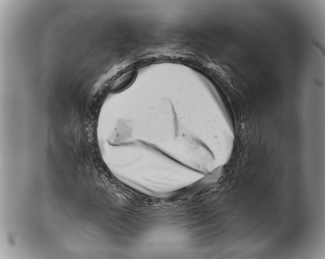 X0000099541159200806131143