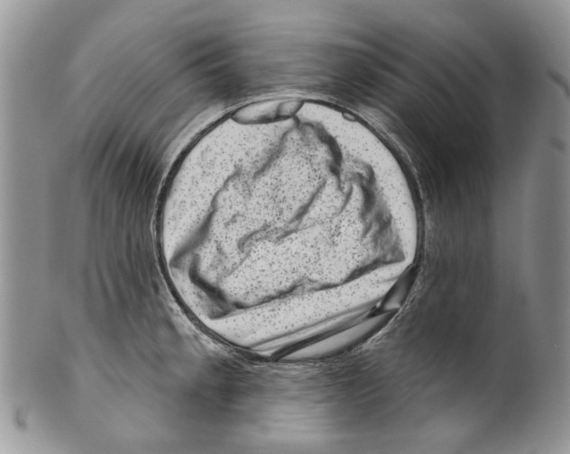 X0000099541189200806131142