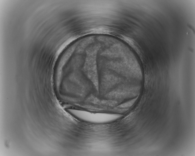 X0000099541331200806131141