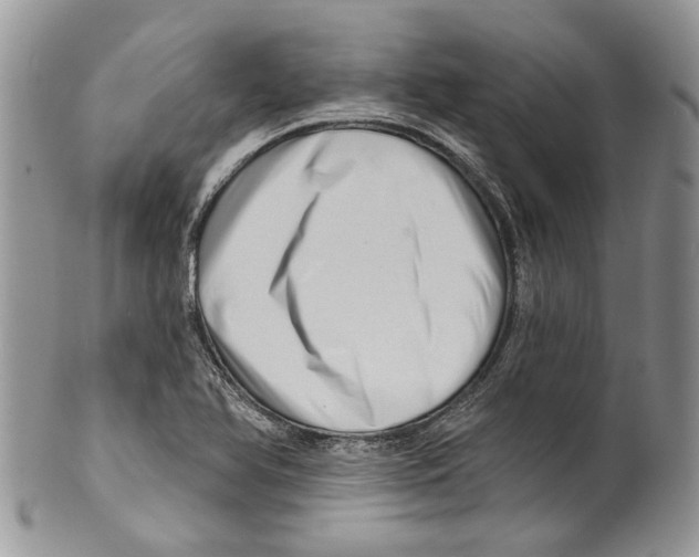 X0000099541366200806131140