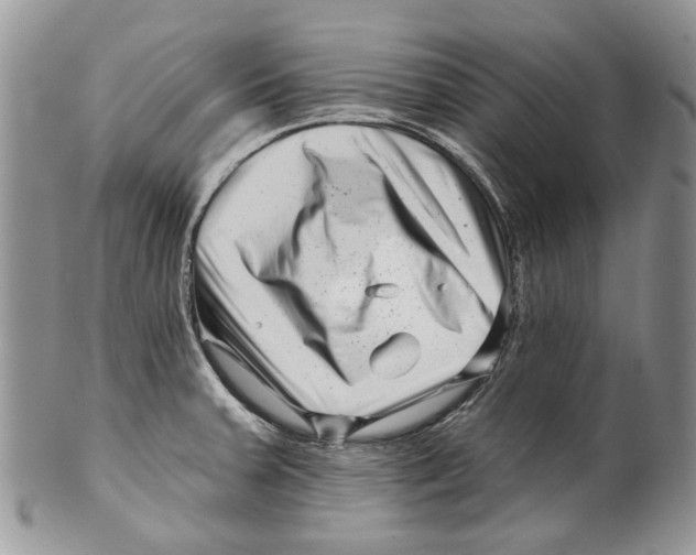 X0000099541379200806131140