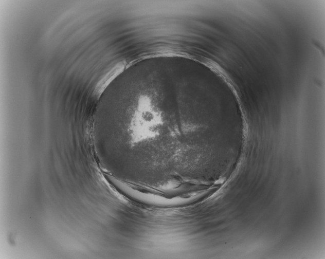 X0000099541385200806131140