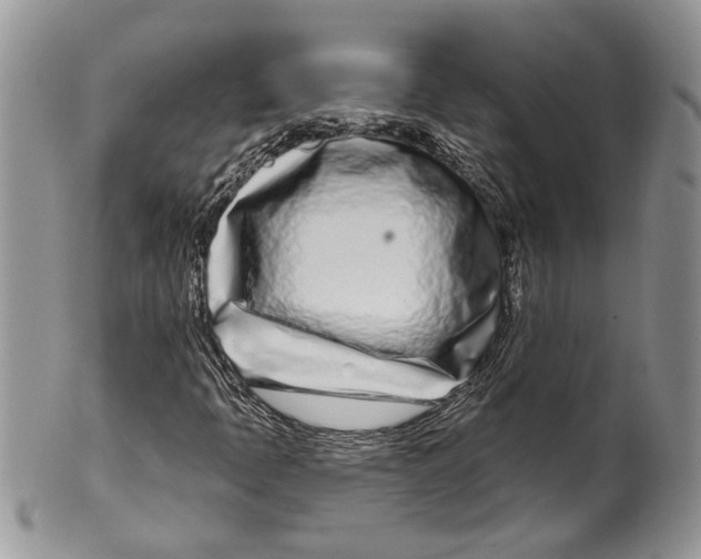 X0000099541397200806131139