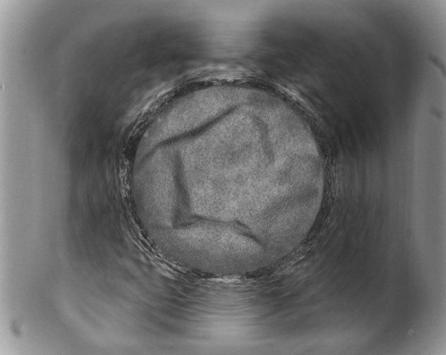 X0000099541399200806131139