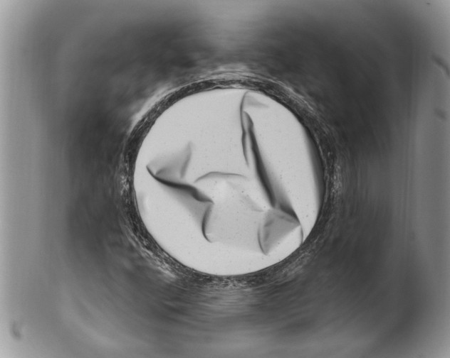 X0000099541400200806131139