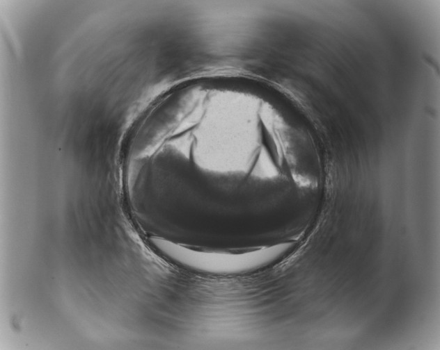 X0000099541414200806131139