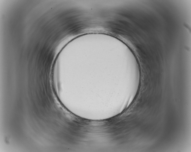 X0000099541440200806131139