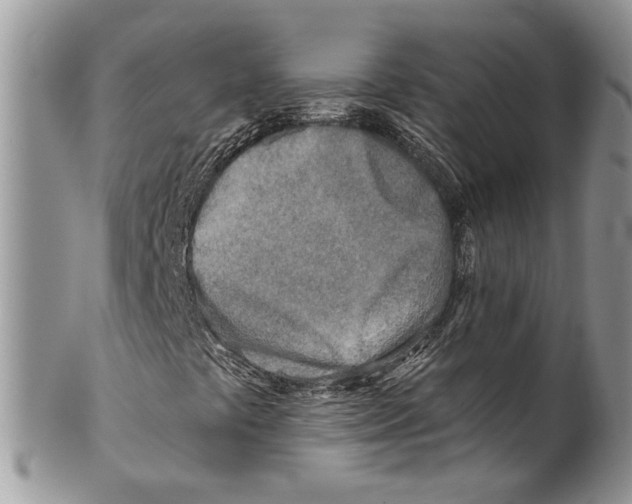 X0000099541441200806131139