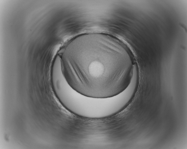 X0000099541477200806131138