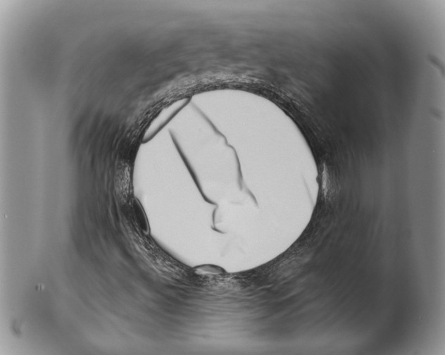 X0000099541492200806131137