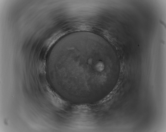X0000099550146200805161500