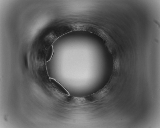 X0000099550429200805161457