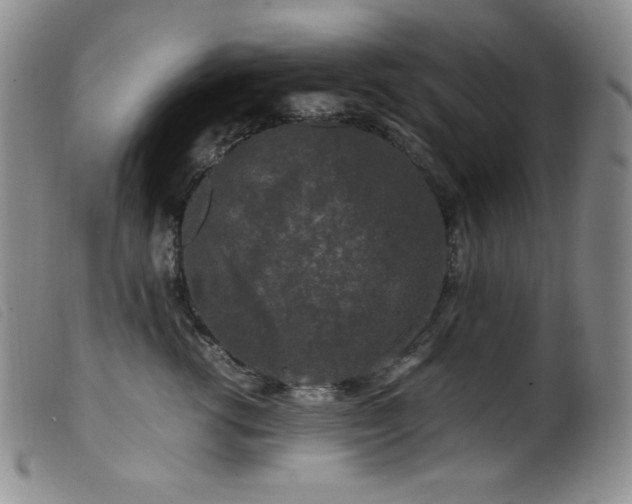 X0000099550762200805161452