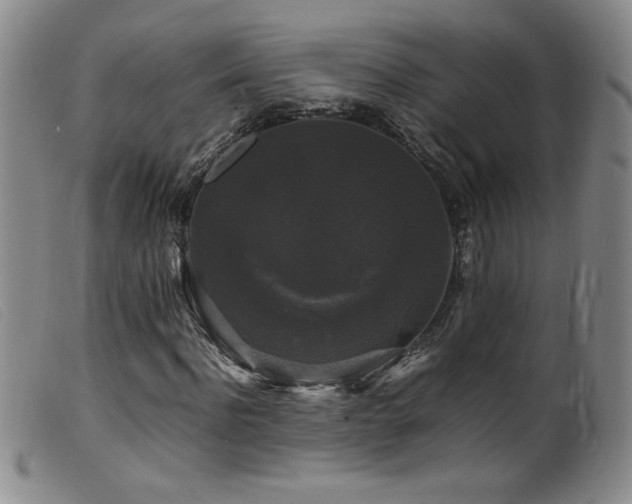 X0000099550916200805161448