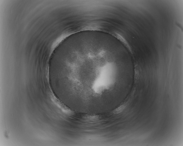 X0000099551035200805161446