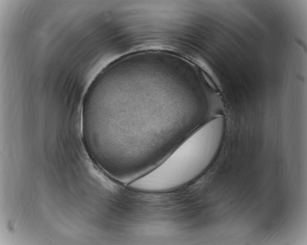 X0000099551132200805161445
