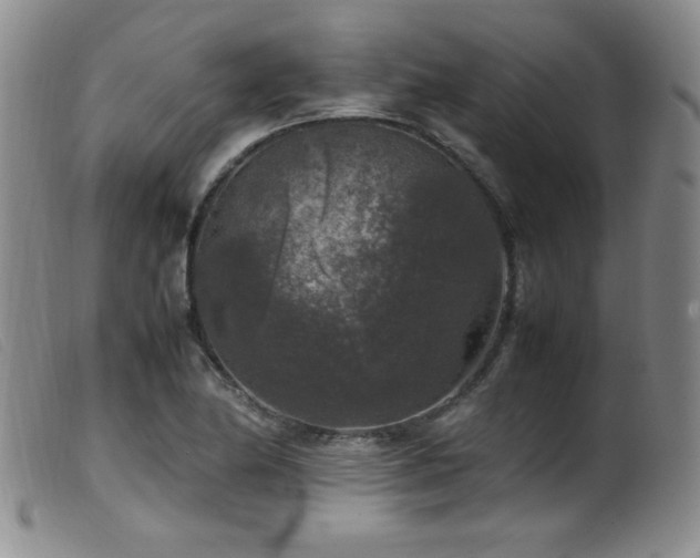 X0000099551174200805161444