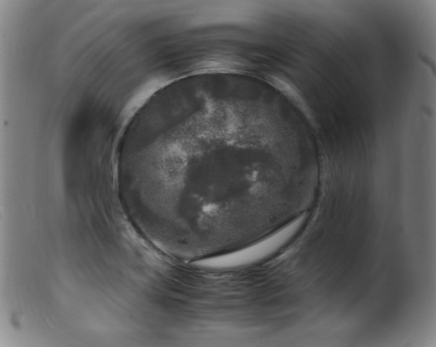 X0000099551419200805161441