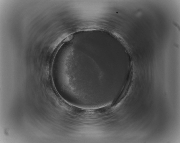 X0000099551457200805161440