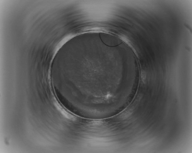 X0000099551482200805161440